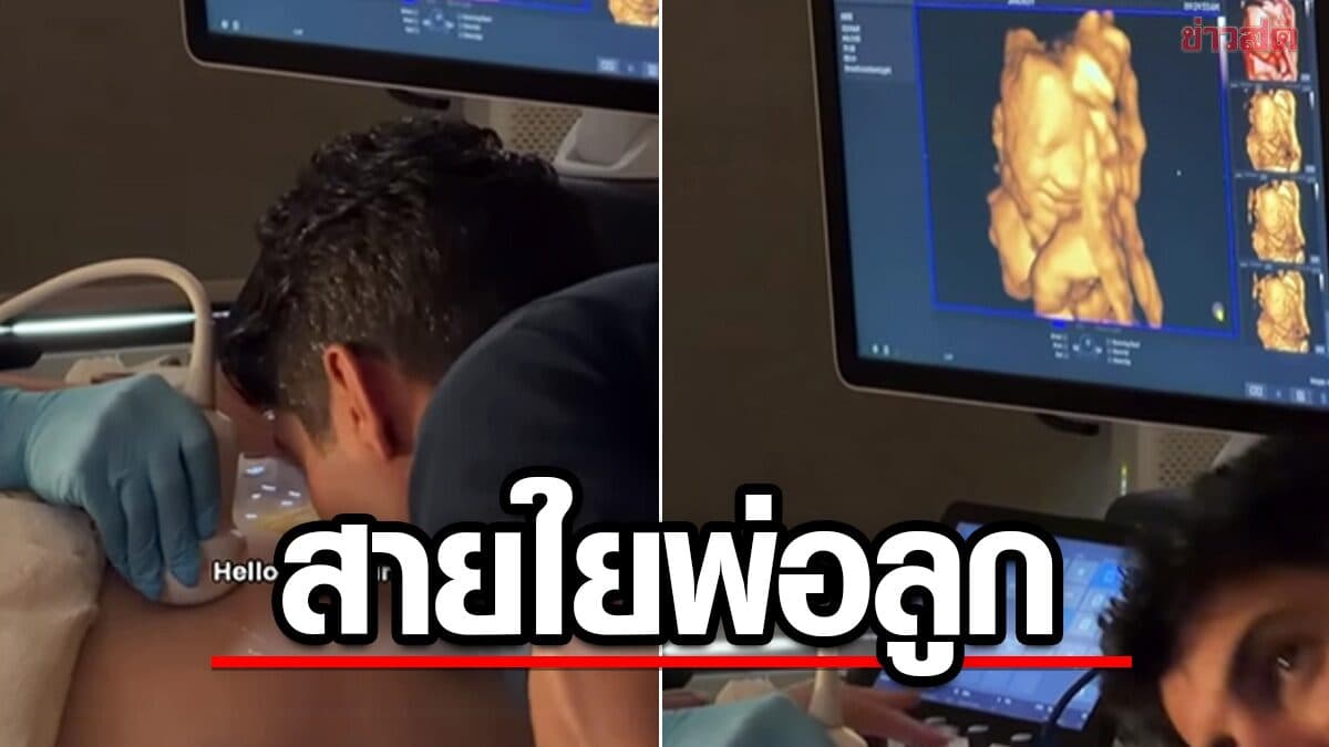 ไวรัล ภาพอัลตราซาวด์ รอยยิ้มลูกน้อย หลังคุณพ่อโน้มตัว จูบหน้าท้องภรรยา แห่ชื่นชม